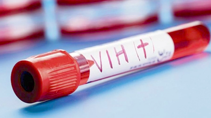 Argentina es el país de la región con mayor cantidad de nuevos casos de VIH por año