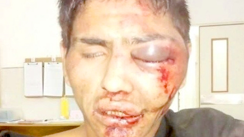 Robó un celular y le desfiguraron la cara a golpes