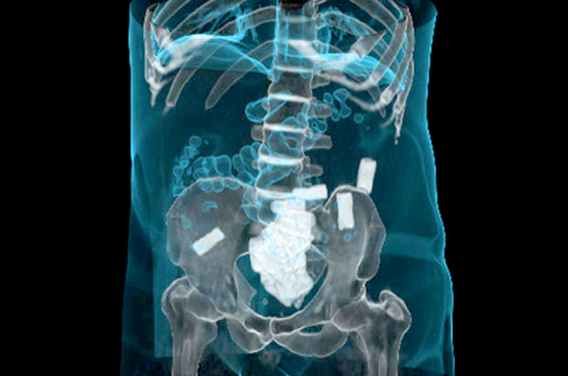 Volvieron las “mulas”: en 2017 creció 175% esa modalidad de tráfico de cocaína