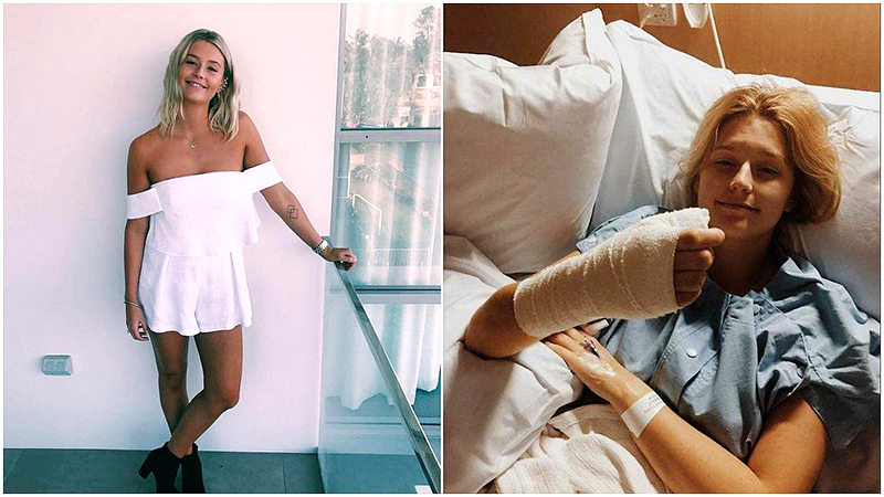 Le amputaron el pulgar por su hábito de comerse las uñas