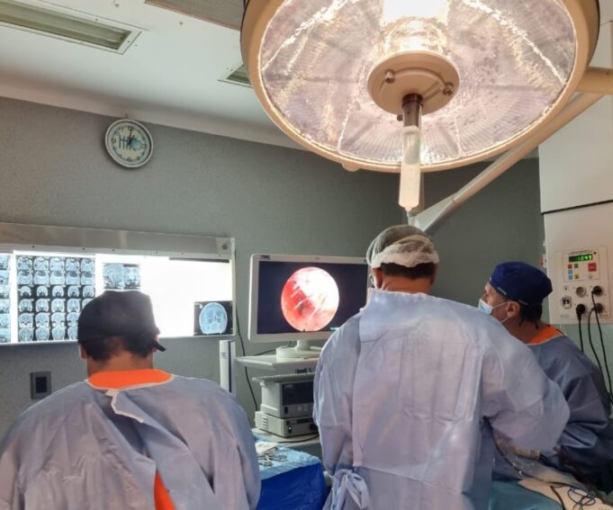 Profesionales del HAC realizaron una innovadora técnica quirúrgica para extirpar un tumor de Hipofisis