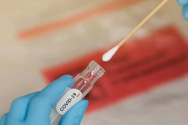 COVID: Durante la semana fallecieron dos mujeres y se reportaron 1.522 nuevos contagios