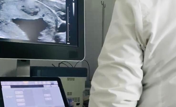 Nueva opción terapéutica en Formosa: Ablación percutánea con etanol para nódulos tiroideos quísticos