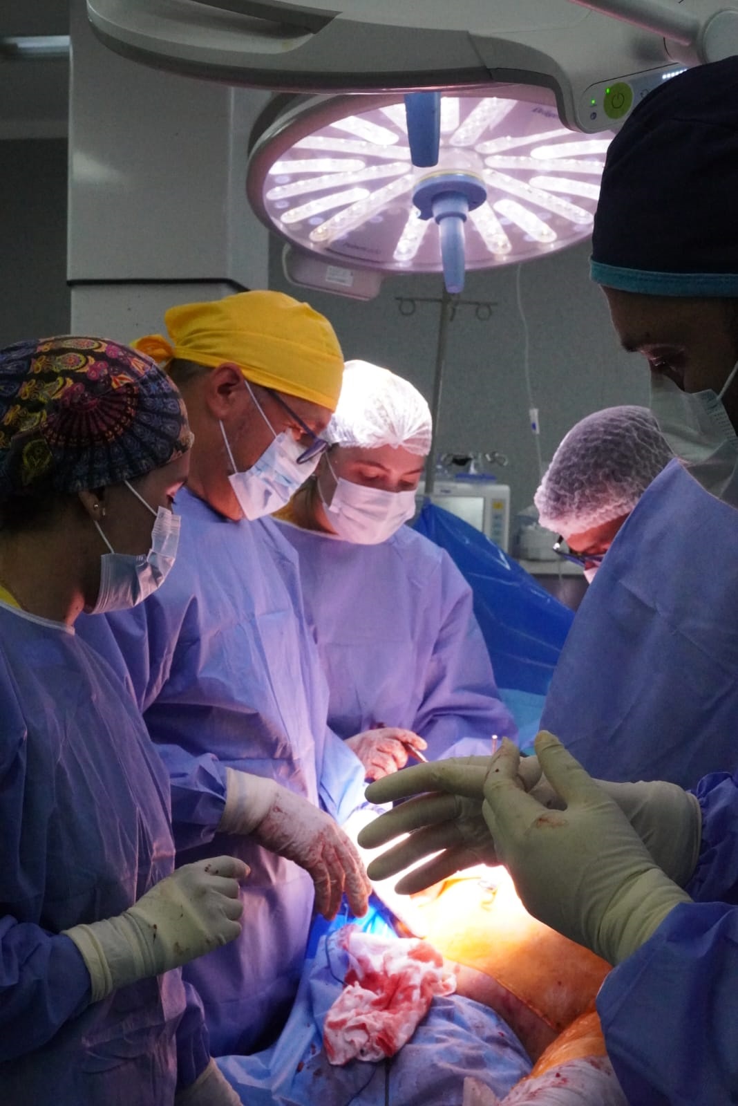 Traumatología del HAC realizó colocación de prótesis oncológica de cadera en paciente derivada del interior